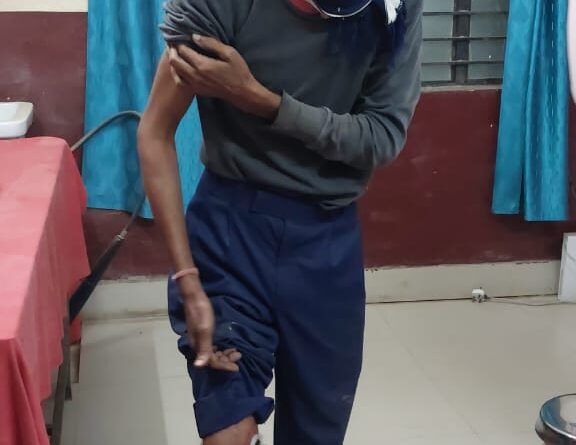 IMG 20241125 WA0008 लोमड़ी के हमले से खुटौना में दहशत दो लोग घायल